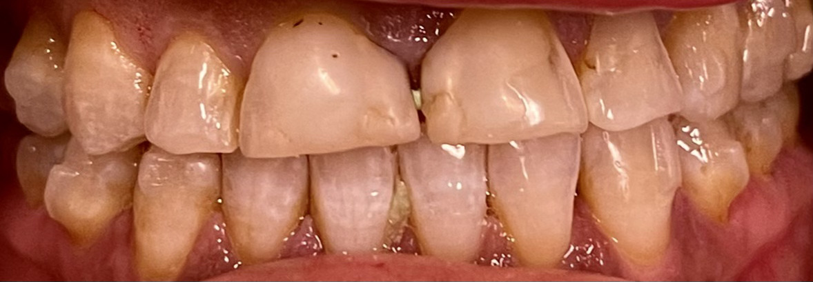 AZ Lifetime Dentistry | E4D, Digital Impressions and Invisalign reg 