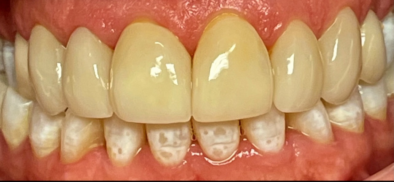 AZ Lifetime Dentistry | Cosmetic Dentistry, Digital Radiography and Veneers