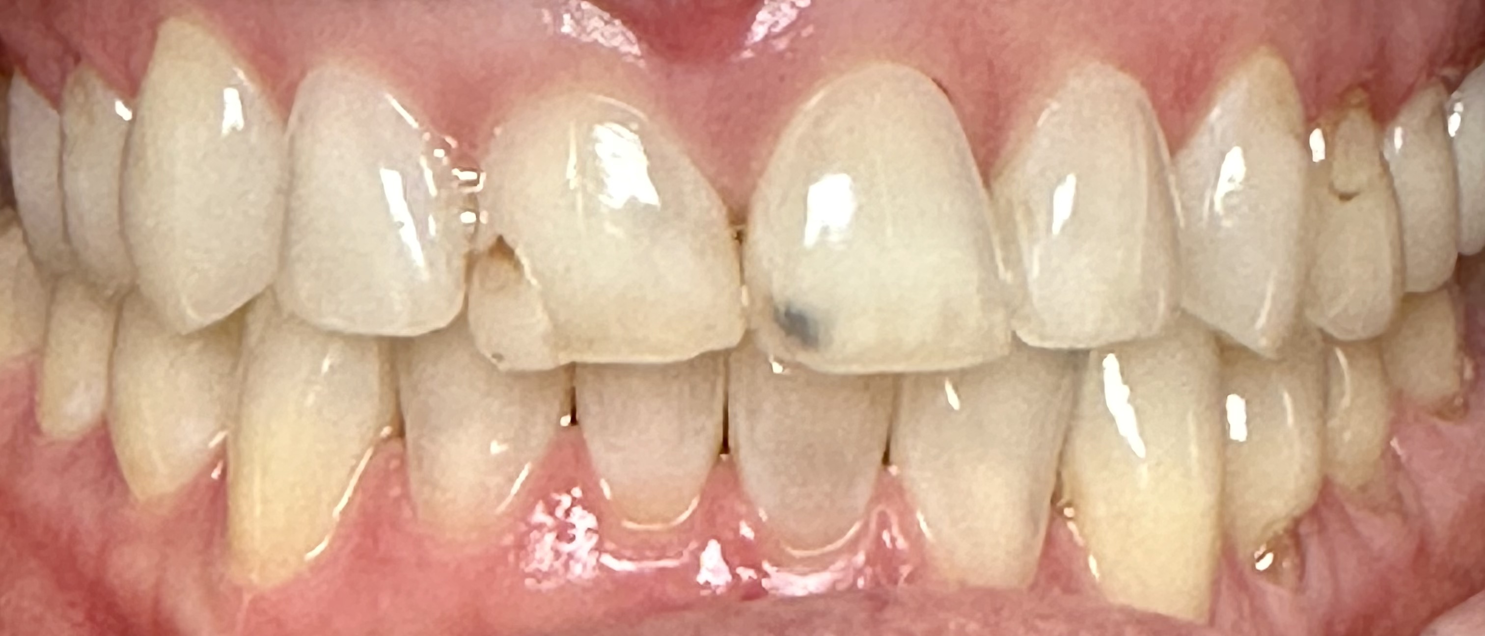 AZ Lifetime Dentistry | Dentures, Laser Dentistry and Implant Restorations