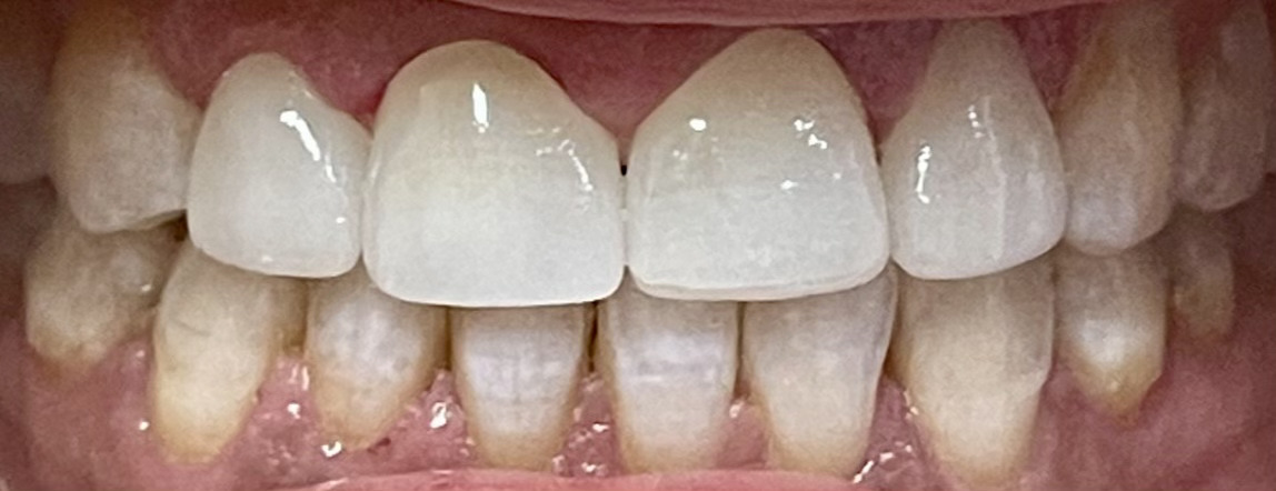 AZ Lifetime Dentistry | Dental Sealants, Botox reg  and Emergency Treatment